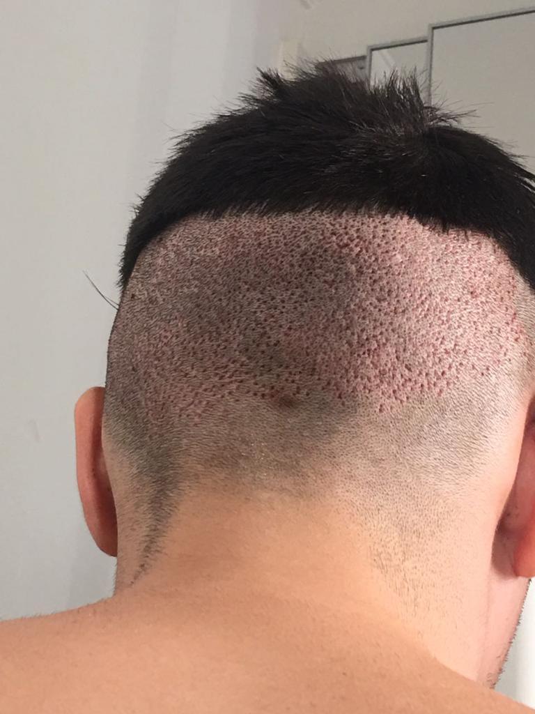 Homem olhando para o lado
