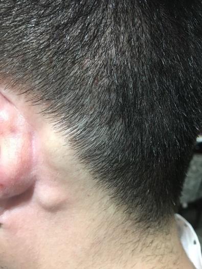 Rosto de homem visto de perto



Descrição gerada automaticamente